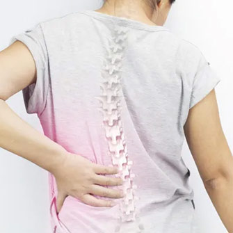 woman and spinal xray